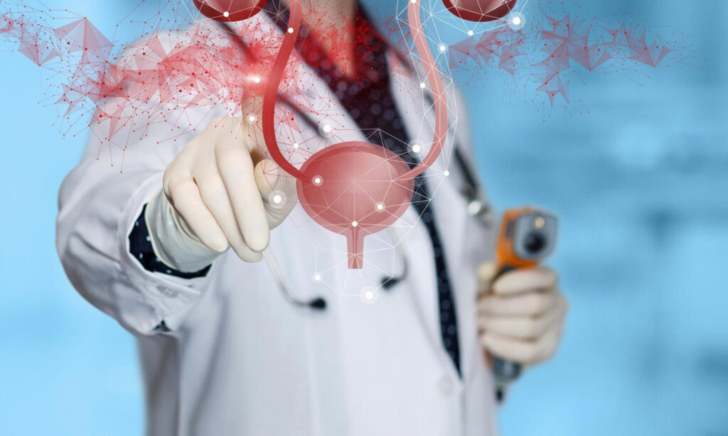 Cistectomia radicale: in cosa consiste